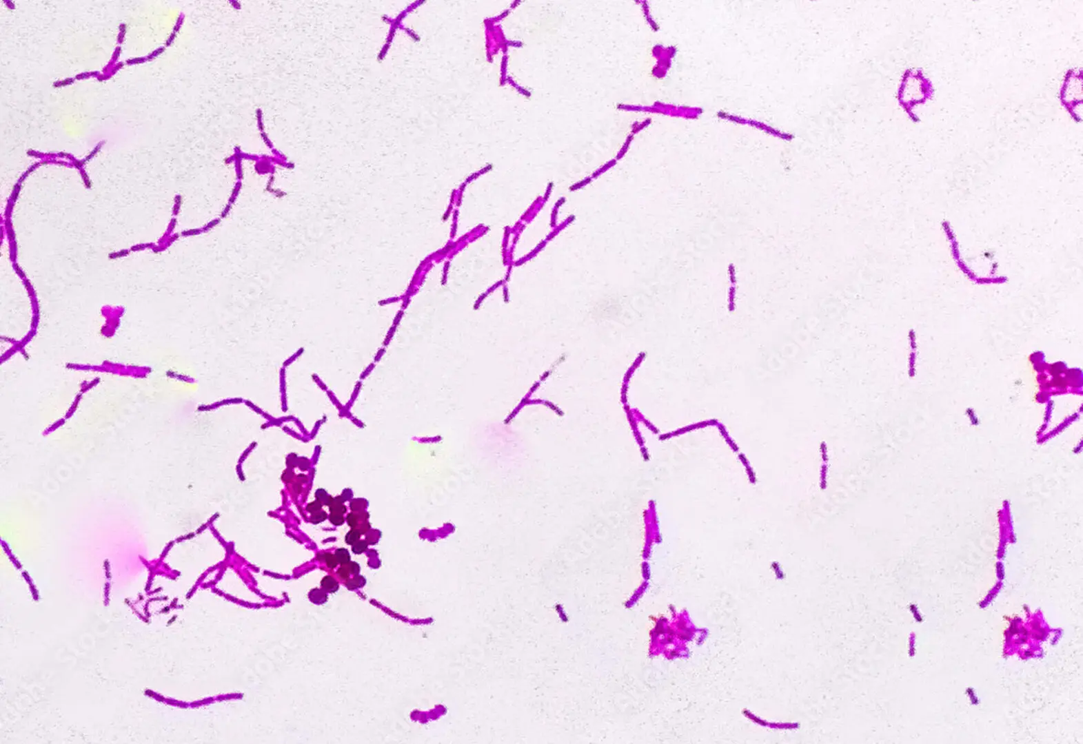 Microscopic view of pink-stained bacterial cells of varying shapes, scattered on a white background, reminiscent of the subtle intricacies in bioenergy healing.